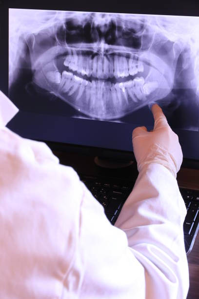 Best Emergency Dentist for Knocked-Out Tooth in Los Alamitos, CA