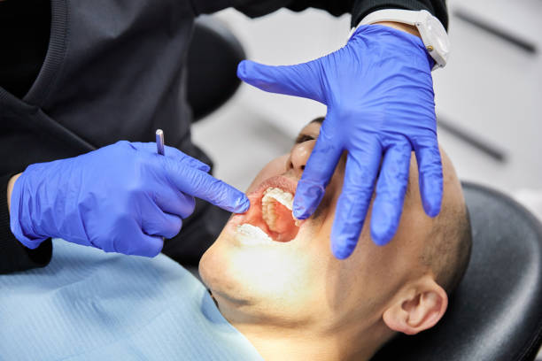 Best Broken or Cracked Tooth Emergency Dentist in Los Alamitos, CA