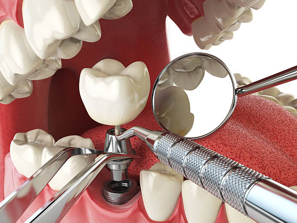 Best Emergency Dental Services for Seniors in Los Alamitos, CA
